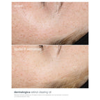 Dermalogica Retinol Clearing Oil - Anti-Aging Night Oil with Salicylic Acid for Acne and Skin Renewal